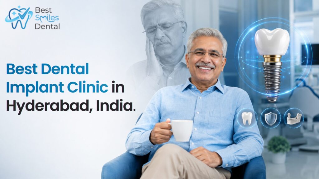 Best Dental Implant Clinic in Hyderabad